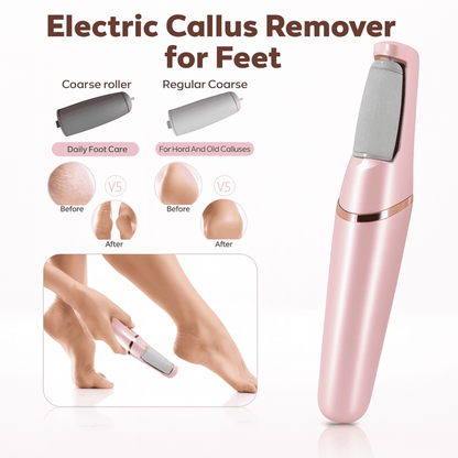Flawless Electronic Foot File – 3 Interchangeable Heads